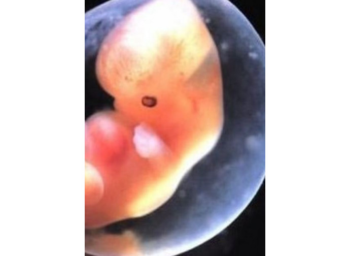 Un embrione